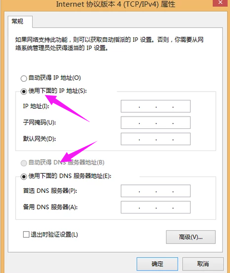 本地连接受限制或无连接怎么解决 本地连接受限制或无连接怎么解决