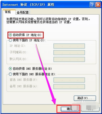 本地连接 本地连接